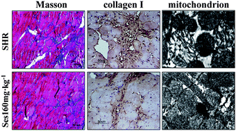 Graphical abstract: Long-term intake of sesamin improves left ventricular remodelling in spontaneously hypertensive rats