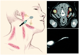 Graphical abstract: Clinically-translated silica nanoparticles as dual-modality cancer-targeted probes for image-guided surgery and interventions