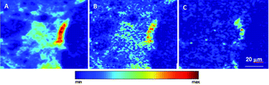 Graphical abstract: A synchrotron radiation micro-X-ray absorption near edge structure study of sulfur speciation in human brain tumors—a methodological approach