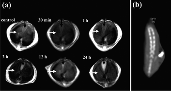 Graphical abstract: Facile assembly of Fe3O4@Au nanocomposite particles for dual mode magnetic resonance and computed tomography imaging applications