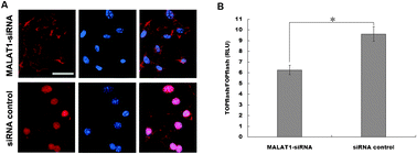 Graphical abstract: Upregulated MALAT-1 contributes to bladder cancer cell migration by inducing epithelial-to-mesenchymal transition