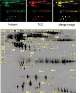 Graphical abstract: Redox- and expression-proteomic analysis of plasma biomarkers in bladder transitional cell carcinoma