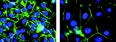 Graphical abstract: Deciphering intracellular targets of organochalcogen based redox catalysts