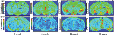 Graphical abstract: The distribution profile and oxidation states of biometals in APP transgenic mouse brain: dyshomeostasis with age and as a function of the development of Alzheimer's disease