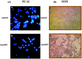 Graphical abstract: Design, synthesis, characterization and DNA-binding studies of a triphenyltin(iv) complex of N-glycoside (GATPT), a sugar based apoptosis inducer: in vitro and in vivo assessment of induction of apoptosis by GATPT