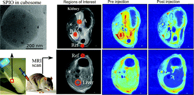 Graphical abstract: Cubic mesophase nanoparticles doped with superparamagnetic iron oxide nanoparticles: a new class of MRI contrast agent