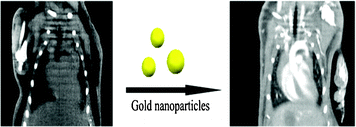 Graphical abstract: Gold nanoparticles as computerized tomography (CT) contrast agents