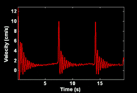 Graphical abstract: Oscillatory settling in wormlike-micelle solutions: bursts and a long time scale