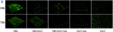 Graphical abstract: Antibacterial properties and bioactivity of HACC- and HACC–Zein-modified mesoporous bioactive glass scaffolds