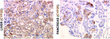 Graphical abstract: Adult human exocrine pancreas differentiation to hepatocytes – potential source of a human hepatocyte progenitor for use in toxicology research