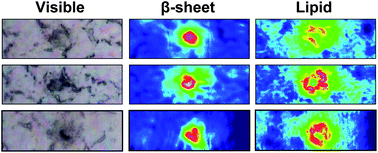 Graphical abstract: Synchrotron FTIR reveals lipid around and within amyloid plaques in transgenic mice and Alzheimer's disease brain