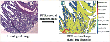 Graphical abstract: Infrared spectral histopathology for cancer diagnosis: a novel approach for automated pattern recognition of colon adenocarcinoma