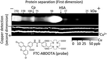 Graphical abstract: Separation of metalloproteins using a novel metal ion contaminant sweeping technique and detection of protein-bound copper by a metal ion probe in polyacrylamide gel electrophoresis: distribution of copper in human serum