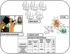 Graphical abstract: In vivo Raman spectroscopy of oral buccal mucosa: a study on malignancy associated changes (MAC)/cancer field effects (CFE)