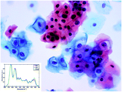 Graphical abstract: Infrared spectroscopy with multivariate analysis segregates low-grade cervical cytology based on likelihood to regress, remain static or progress