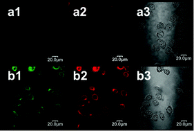 Graphical abstract: The conjugates of gold nanorods and chlorin e6 for enhancing the fluorescence detection and photodynamic therapy of cancers