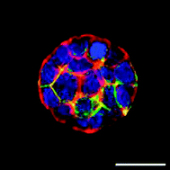 Graphical abstract: Growth of confined cancer spheroids: a combined experimental and mathematical modelling approach