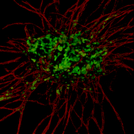 Graphical abstract: A three-dimensional in vitro model of tumor cell intravasation