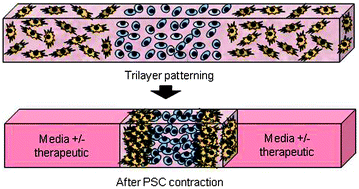 Graphical abstract: A bioengineered heterotypic stroma–cancer microenvironment model to study pancreatic ductal adenocarcinoma