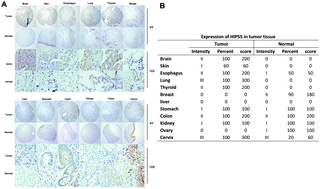 Graphical abstract: Regulation of cell survival by the HIP-55 signaling network