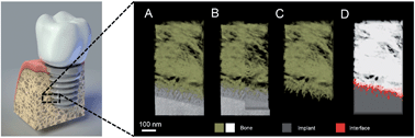 Graphical abstract: Where bone meets implant: the characterization of nano-osseointegration