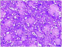 Graphical abstract: Silver nanoparticles: a novel radiation sensitizer for glioma?