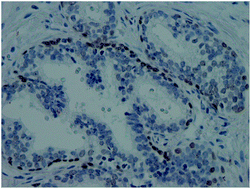 Graphical abstract: Two-color SERS microscopy for protein co-localization in prostate tissue with primary antibody–protein A/G–gold nanocluster conjugates