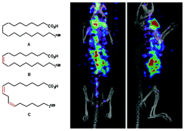 Graphical abstract: Synthesis of new 123I-labeled free fatty acids analogues and first evaluation as potential tracers for SPECT imaging to elucidate fatty acid flux in mouse