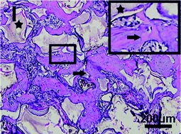 Graphical abstract: Strontium-incorporated mesoporous bioactive glass scaffolds stimulating in vitro proliferation and differentiation of bone marrow stromal cells and in vivo regeneration of osteoporotic bone defects