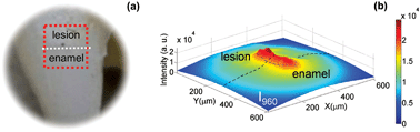 Graphical abstract: Wide-field Raman imaging of dental lesions