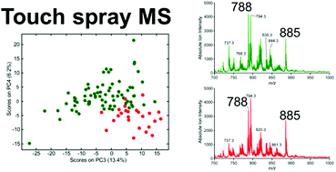 Graphical abstract: Differentiation of prostate cancer from normal tissue in radical prostatectomy specimens by desorption electrospray ionization and touch spray ionization mass spectrometry