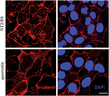 Graphical abstract: Quercetin reduces pluripotency, migration and adhesion of human teratocarcinoma cell line NT2/D1 by inhibiting Wnt/β-catenin signaling