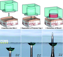 Graphical abstract: A self-powered one-touch blood extraction system: a novel polymer-capped hollow microneedle integrated with a pre-vacuum actuator