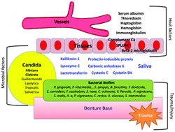 Graphical abstract: Role of salivary and candidal proteins in denture stomatitis: an exploratory proteomic analysis