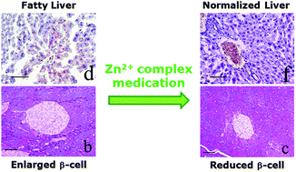 Graphical abstract: Morphological analysis of the pancreas and liver in diabetic KK-Ay mice treated with zinc and oxovanadium complexes
