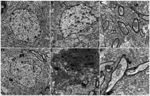 Graphical abstract: The discrepancy between the absence of copper deposition and the presence of neuronal damage in the brain of Atp7b−/− mice