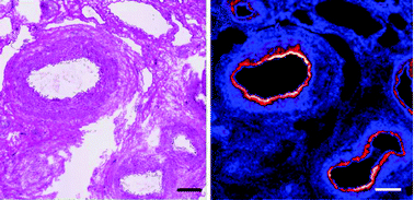 Graphical abstract: Distribution and speciation of bromine in mammalian tissue and fluids by X-ray fluorescence imaging and X-ray absorption spectroscopy