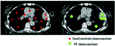 Graphical abstract: Nanoparticle delivery of chemosensitizers improve chemotherapy efficacy without incurring additional toxicity