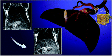 Graphical abstract: Development of biocompatible nanocubes as a T1-contrast enhancer for MR imaging of primary and metastatic liver cancer