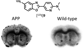 Graphical abstract: Synthesis and biological evaluation of 123I-labeled pyridyl benzoxazole derivatives: novel β-amyloid imaging probes for single-photon emission computed tomography