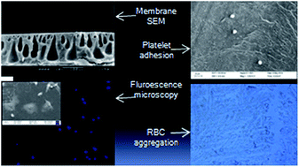 Graphical abstract: In vitro cytocompatibility and blood compatibility of polysulfone blend, surface-modified polysulfone and polyacrylonitrile membranes for hemodialysis