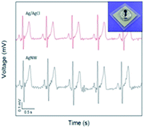 Graphical abstract: Wearable silver nanowire dry electrodes for electrophysiological sensing