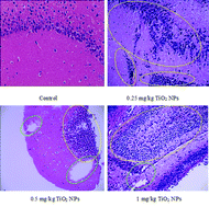 Graphical abstract: Involvement of neurotrophins and related signaling genes in TiO2 nanoparticle – induced inflammation in the hippocampus of mice