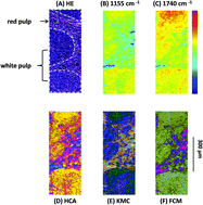 Graphical abstract: Application of mid-infrared (MIR) microscopy imaging for discrimination between follicular hyperplasia and follicular lymphoma in transgenic mice
