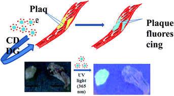 Graphical abstract: Detection and imaging of fatty plaques in blood vessels using functionalized carbon dots