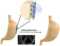 Graphical abstract: Mussel-inspired nanofibrous sheet for suture-less stomach incision surgery