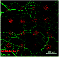 Graphical abstract: Printing cancer cells into intact microvascular networks: a model for investigating cancer cell dynamics during angiogenesis