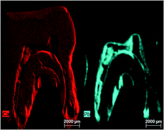 Graphical abstract: Quantitative evaluation of ante-mortem lead in human remains of the 18th century by triaxial geometry and bench top micro X-ray fluorescence spectrometry