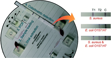 Graphical abstract: An integrated slidable and valveless microdevice with solid phase extraction, polymerase chain reaction, and immunochromatographic strip parts for multiplex colorimetric pathogen detection