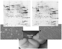 Graphical abstract: Comparative proteomic analysis of two distinct stem-cell populations from human amniotic fluid